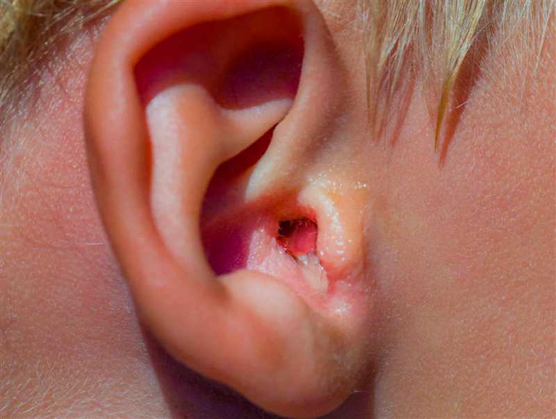 نکات حیاتی برای پیشگیری از عفونت های گوش