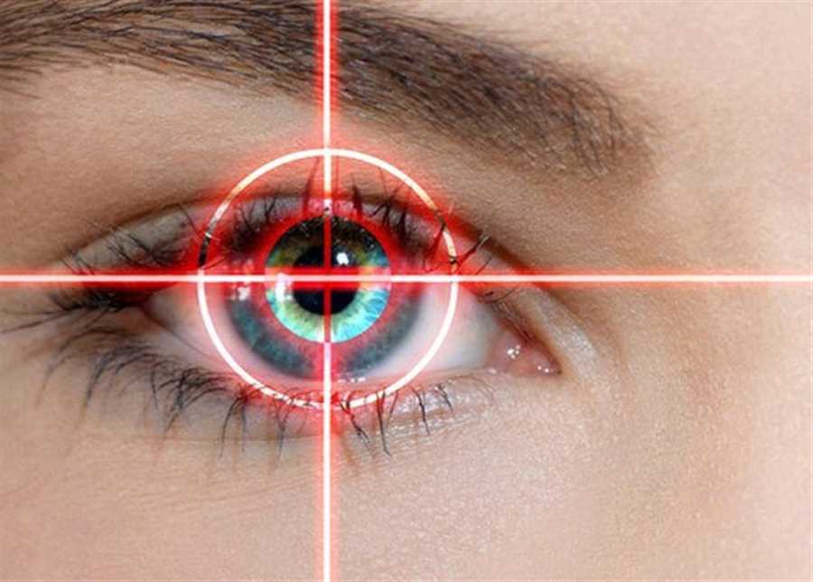 عمل لیزر چشم در شیراز | سینا پزشک