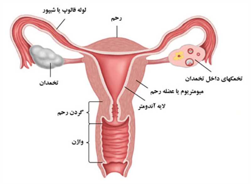 6 روش درمان تنبلی تخمدان در شیراز و 4 دلیل ایجاد آن