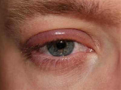 چشم افراد ممکن است به دلایل مختلفی دچار بیماری یا عارضه شود، به همین دلیل شناخت بیماری های چشم از اهمیت ویژه ای برخوردار است. 