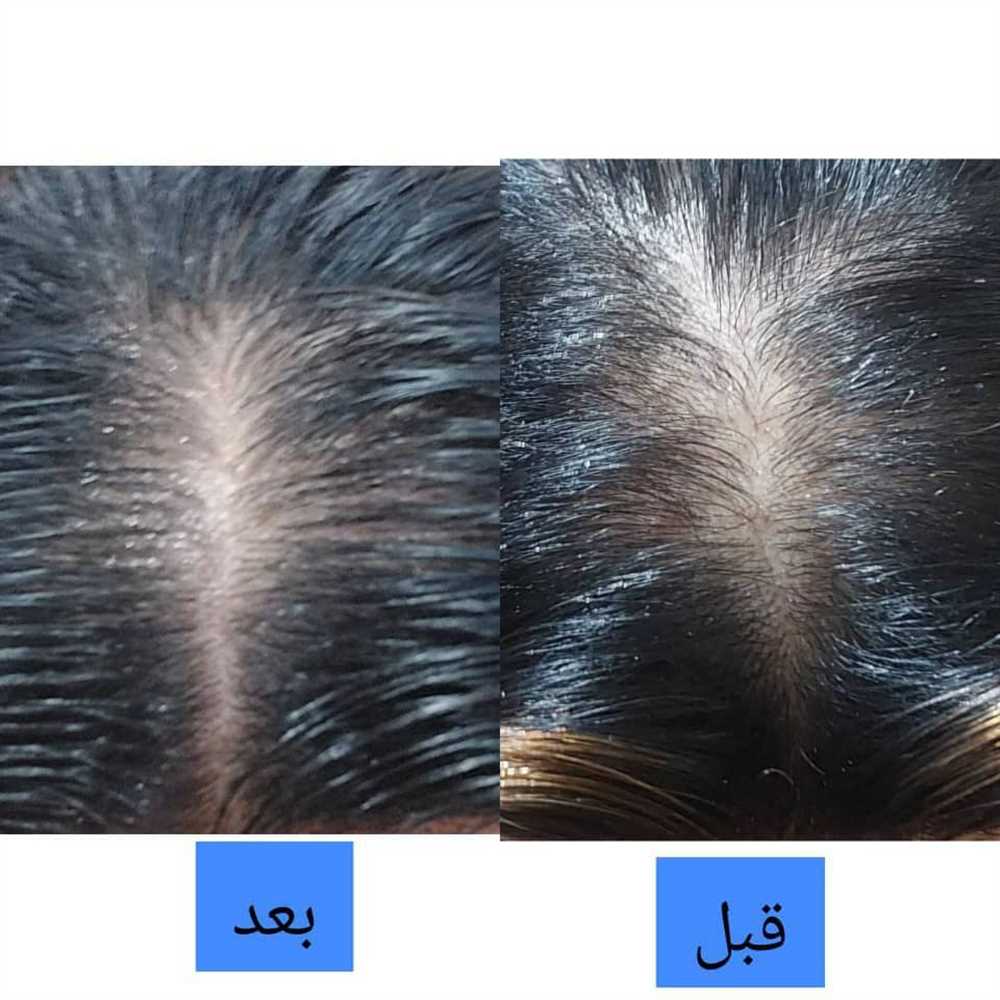 نتیجه ی استفاده از روغن گیاسین برای جلوگیری از ریزش مو